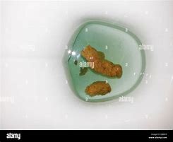 excrement