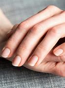 nail